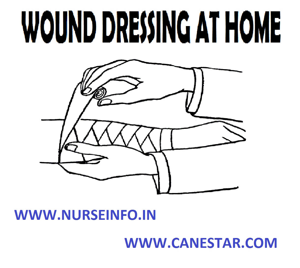 WOUND DRESSING AT HOME Nurse Info