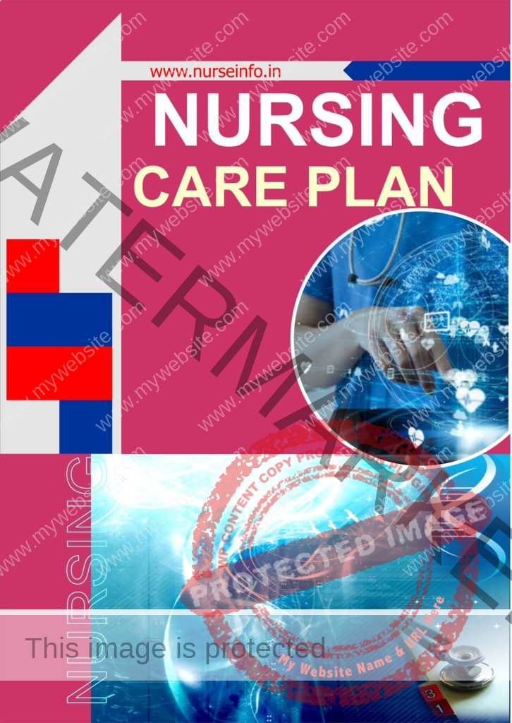 Pediatric Nursing Care Plans PDF Book Nurse Info   NURSING CARE PLAN NEW COVER 726x1024 