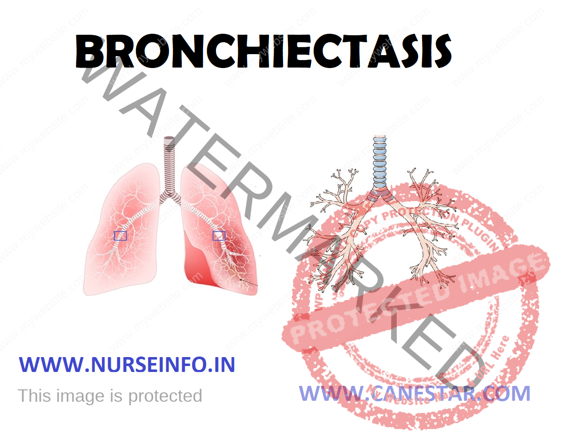 BRONCHIECTASIS - Nurse Info