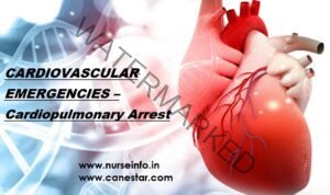 Cardiopulmonary Arrest - Nurse Info