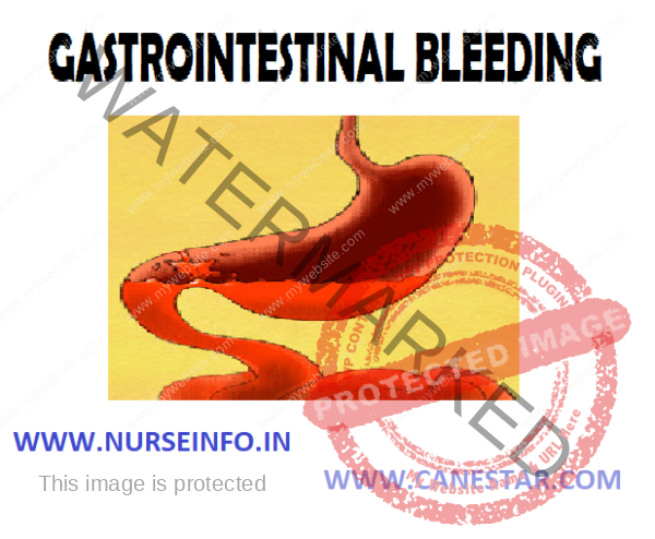 GASTROINTESTINAL BLEEDING - Nurse Info