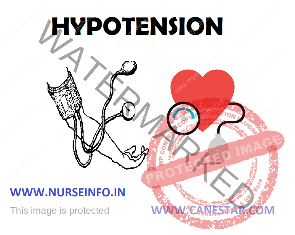 hypotension-nurse-info