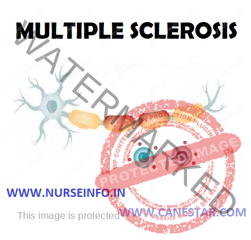  MULTIPLE SCLEROSIS (MS) – Etiology and Risk Factors, Pathophysiology, Signs and Symptoms, Complications, Diagnostic Evaluation and Management  