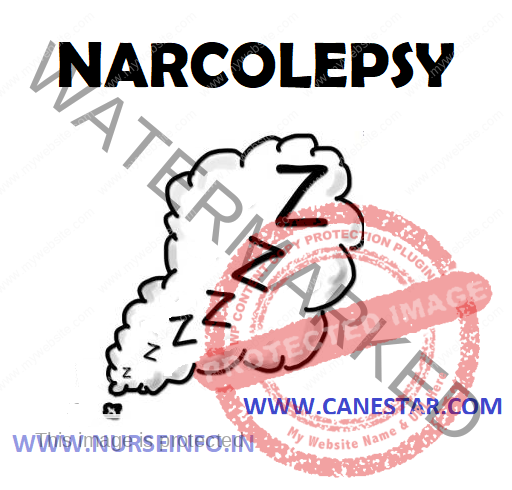 NARCOLEPSY – Etiology, Signs and Symptoms, Diagnostic Evaluation and Management (Medical and Nursing) 