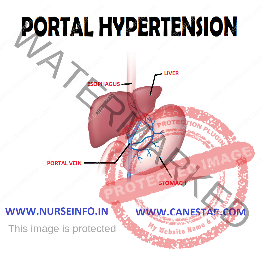 clinical presentation of portal hypertension