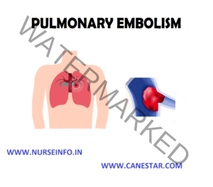 embolism pulmonary etiology pathophysiology diagnostic manifestation