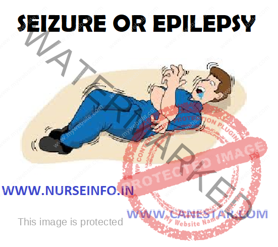 SEIZURE OR EPILEPSY – Types, Etiology, Diagnostic Evaluation and Nursing Management 