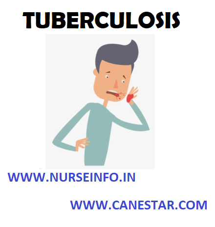 TUBERCULOSIS – Etiology, Risk Factors, Types, Pathophysiology, Clinical Manifestations, Diagnostic Evaluation, Management (Medical and Nursing)