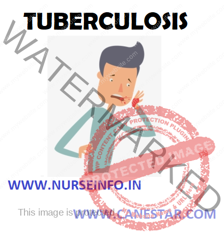 TUBERCULOSIS – Etiology, Risk Factors, Types, Pathophysiology, Clinical Manifestations, Diagnostic Evaluation, Management (Medical and Nursing) 