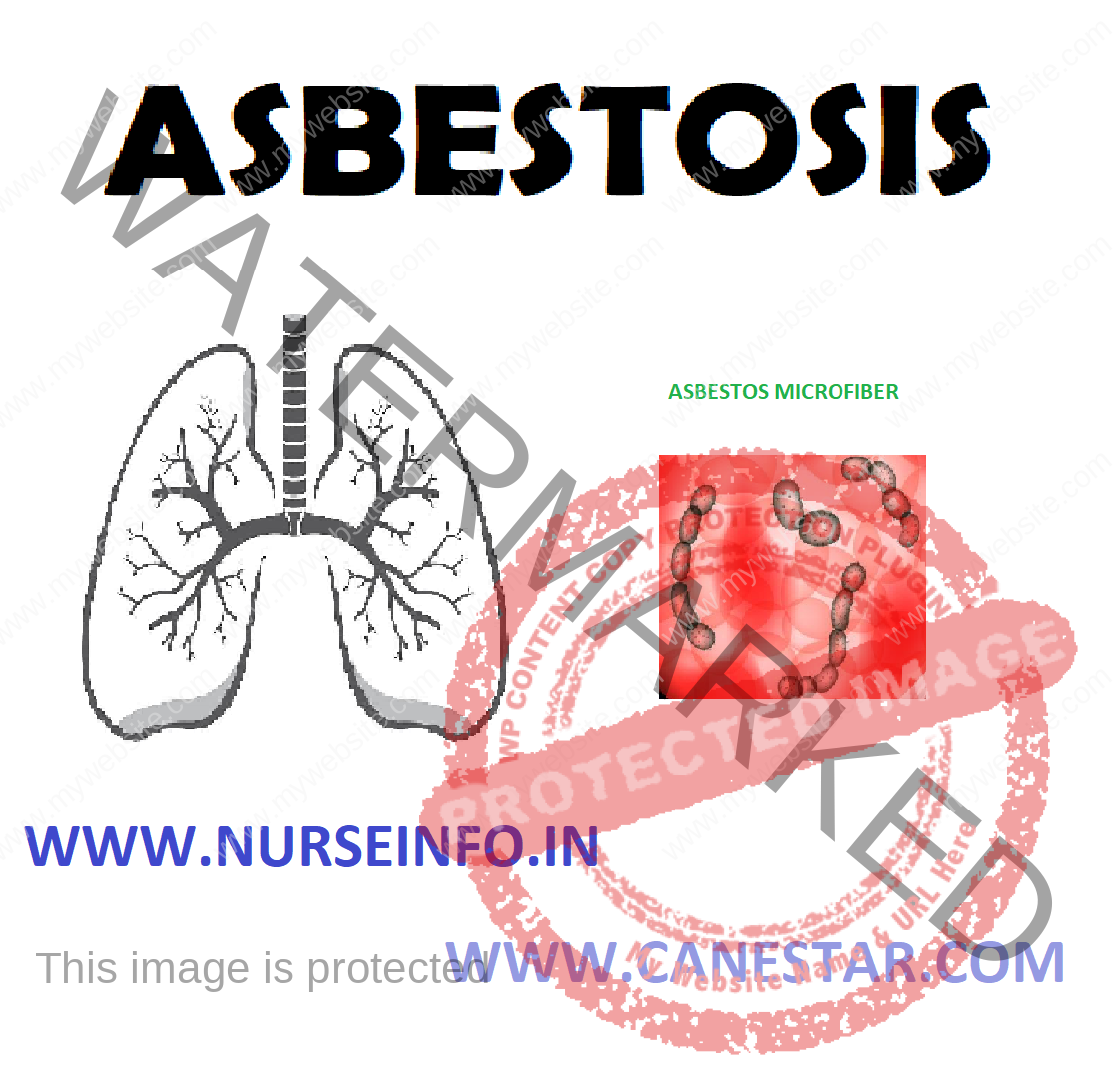 Asbestosis Nurse Info 7849