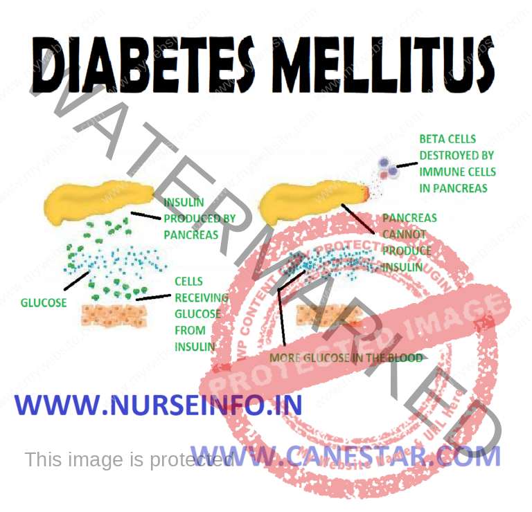 diabetes-mellitus-nurse-info