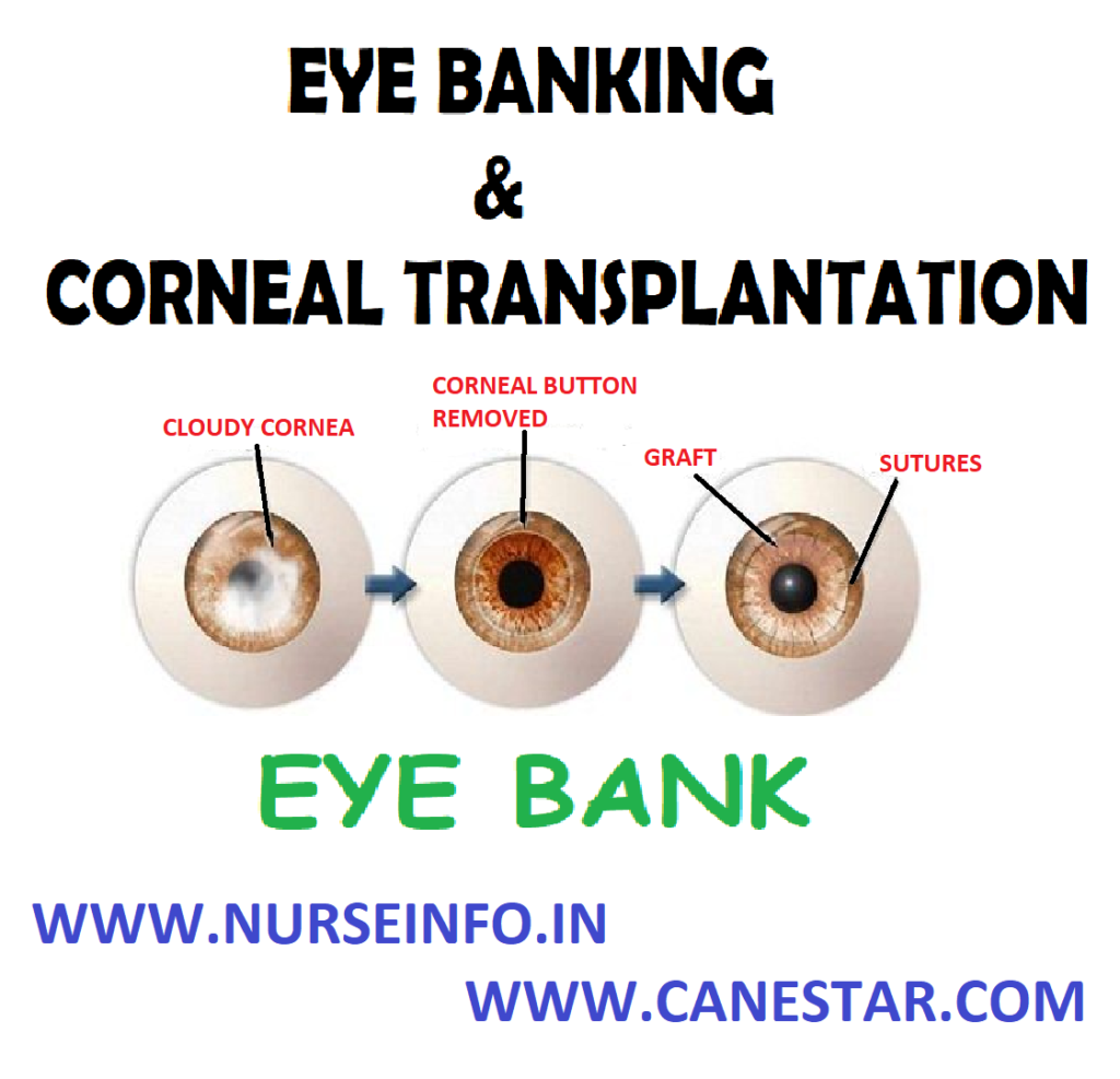 FUNCTIONS OF EYE BANK, CONTRAINDICATIONS FOR DONATION, RETRIEVAL PROCEDURE, ROLE OF NURSE DURING CORNEAL TRANSPLANTATION, AFTER SURGERY and HOME CARE INSTRUCTIONS 