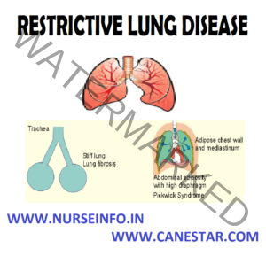 RESTRICTIVE LUNG DISEASES - Nurse Info