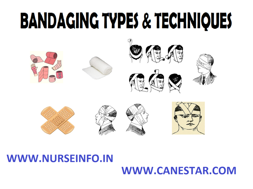 BANDAGING (Definition, Purpose, General Principles, Types and Techniques)
