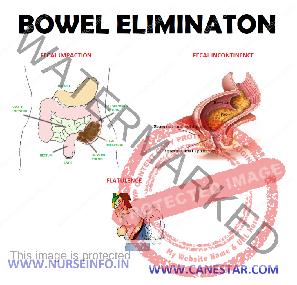 BOWEL ELIMINATION – Factors Affecting and Common Problems in Bowel Elimination (Bristol Stool Chart and Color of Stool and its causes) 