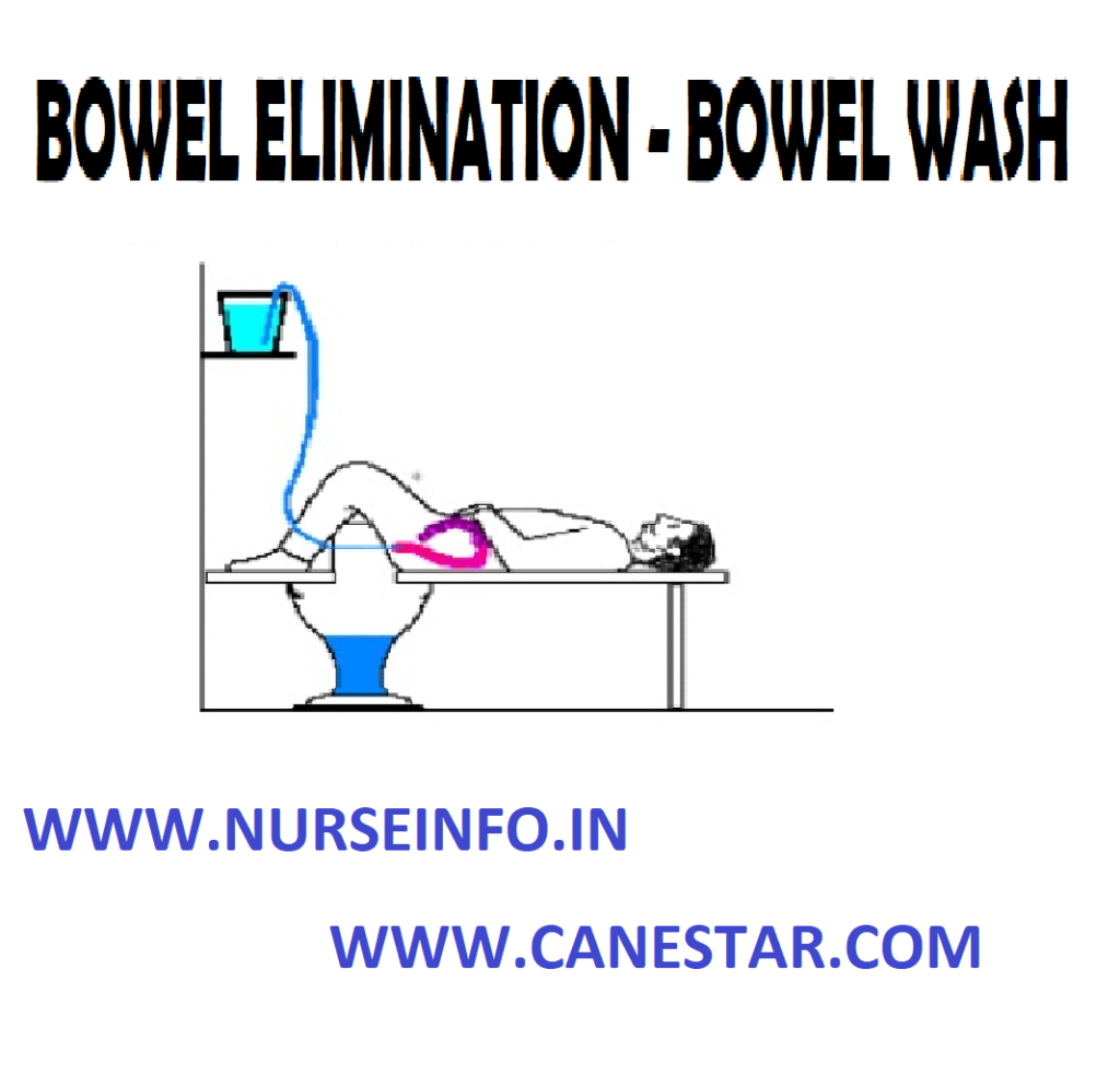 BOWEL WASH – BOWEL ELIMINATION (Purpose, Contraindications, General Instructions, Methods Used, Solutions Used, Preliminary Assessment, Preparation of Patient and Environment, Equipment, Procedure and After Care) 