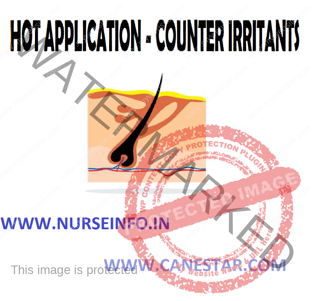 COUNTERIRRITANTS (Hot Application) – Purpose, Classification, Preliminary Assessment, Preparation of Patient and Environment, Equipment, Procedure and After Care