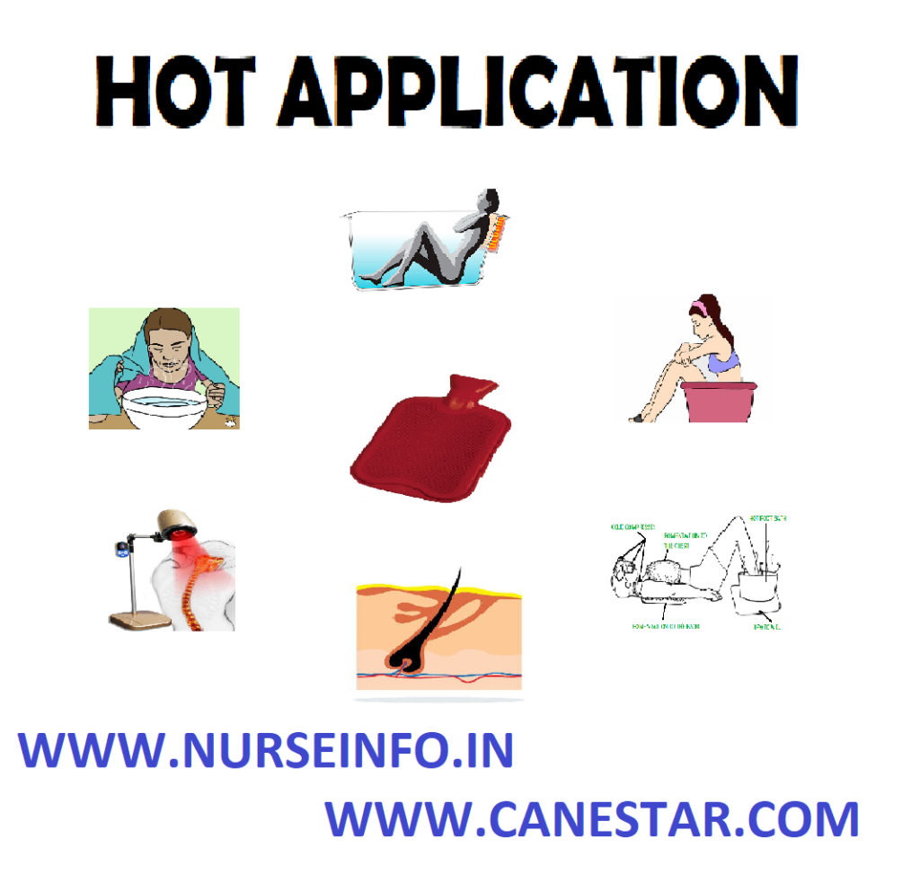 NURSING PROCEDURE – HOT APPLICATION (Definition, Purpose, Classification, Physiological Effects, Principles, Complications and General Instructions 