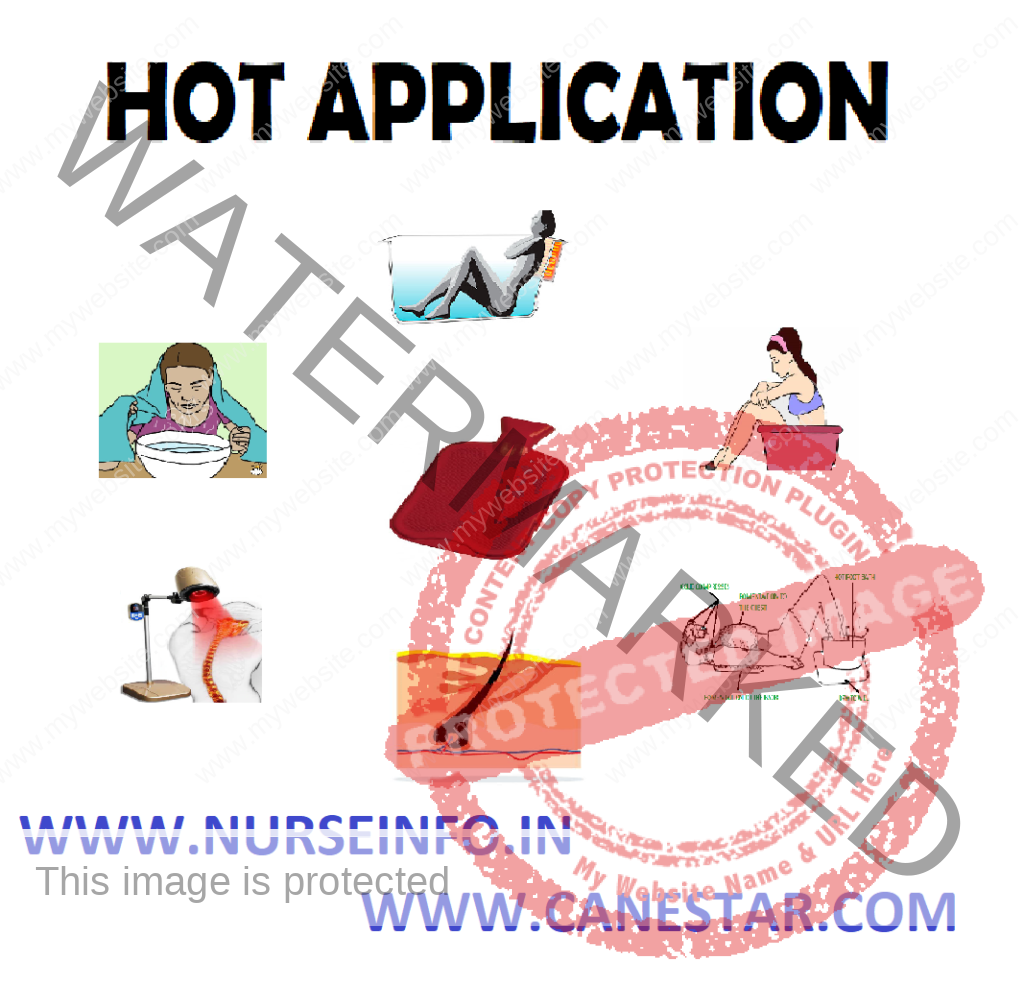 NURSING PROCEDURE – HOT APPLICATION (Definition, Purpose, Classification, Physiological Effects, Principles, Complications and General Instructions 