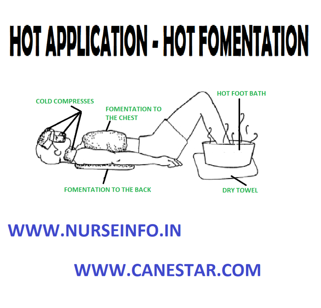 HOT FOMENTATION (Hot Application) - Purpose, Classification, Preliminary Assessment, Preparation of Patient and Environment, Equipment, Procedure and After Care