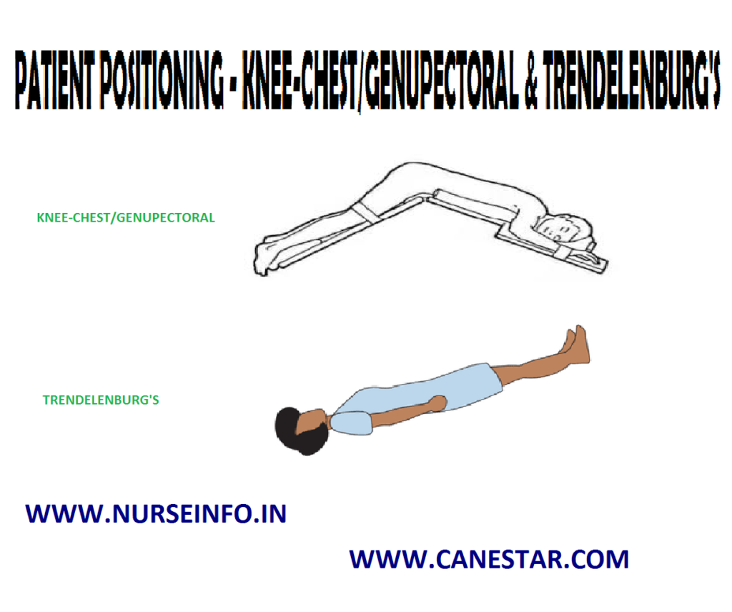 PATIENT POSITIONING – KNEE-CHEST/GENUPECTORAL & TRENDELENBURG'S POSITION - Purpose, Principles, Factors Involved, Types, General Instructions, Preliminary Assessment, Equipment and Procedure