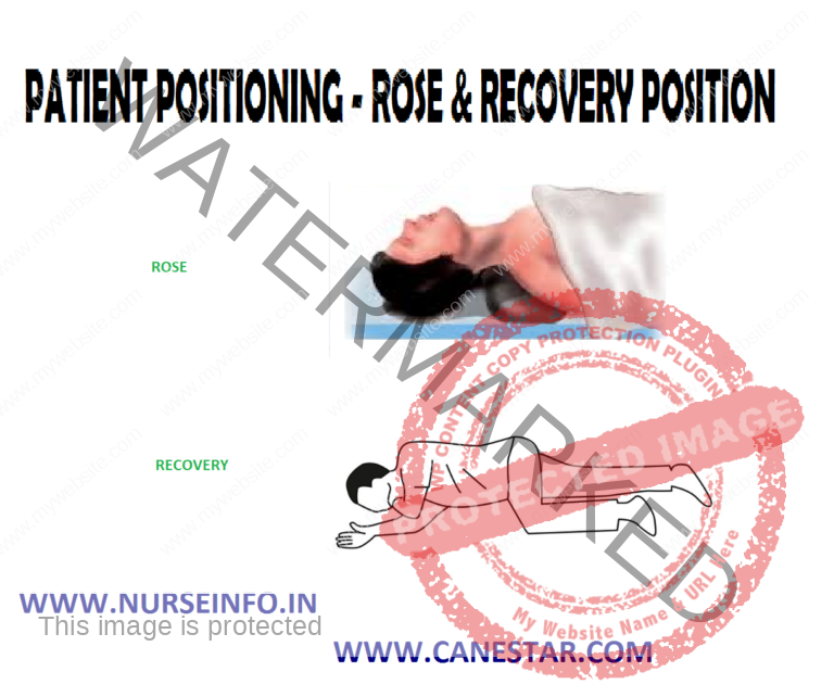 PATIENT POSITIONING ROSE & RECOVERY POSITION Nurse Info