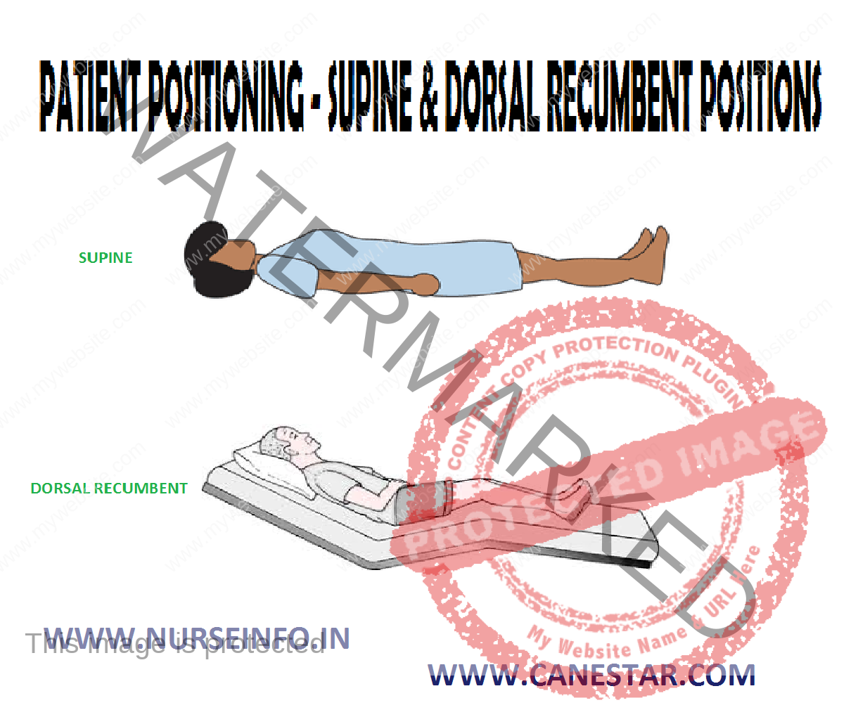 Patient Positioning Supine And Dorsal Recumbent Position Nurse Info 5600