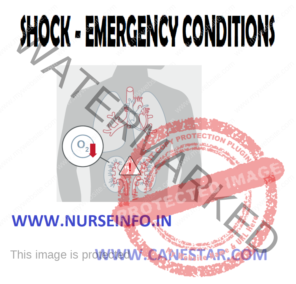 EMERGENCY CONDITIONS – Shock (Etiology, Pathophysiology, Signs and Symptoms, Diagnostic Evaluation and Management) 