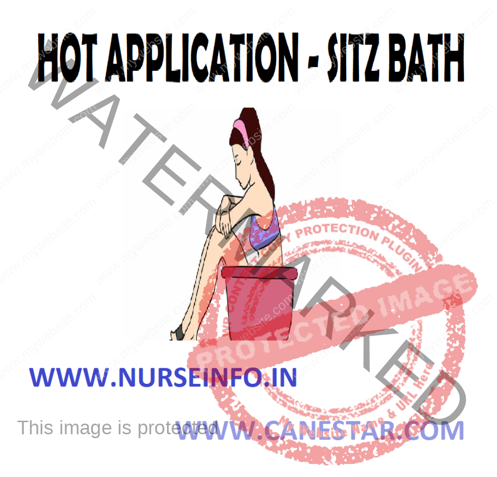 SITZ BATH (HOT APPLICATION) – Purpose, Preliminary Assessment, Preparation of Patient and Environment, Equipment, Procedure and After Care