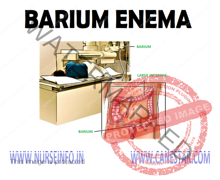BARIUM ENEMA Nurse Info