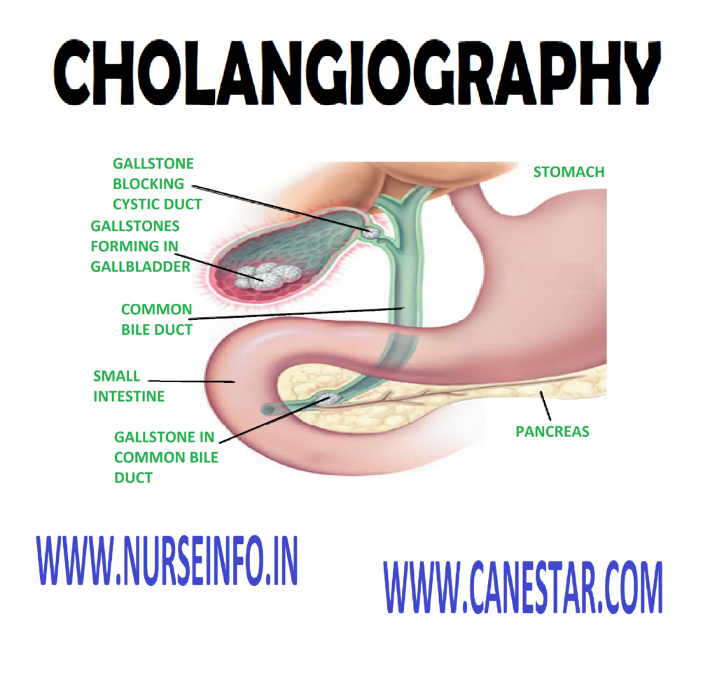 CHOLANGIOGRAPHY (INTRAVENOUS, PERCUTANEOUS, T-TUBE) - Description, Clinical Problem, Client Preparation and Procedure
