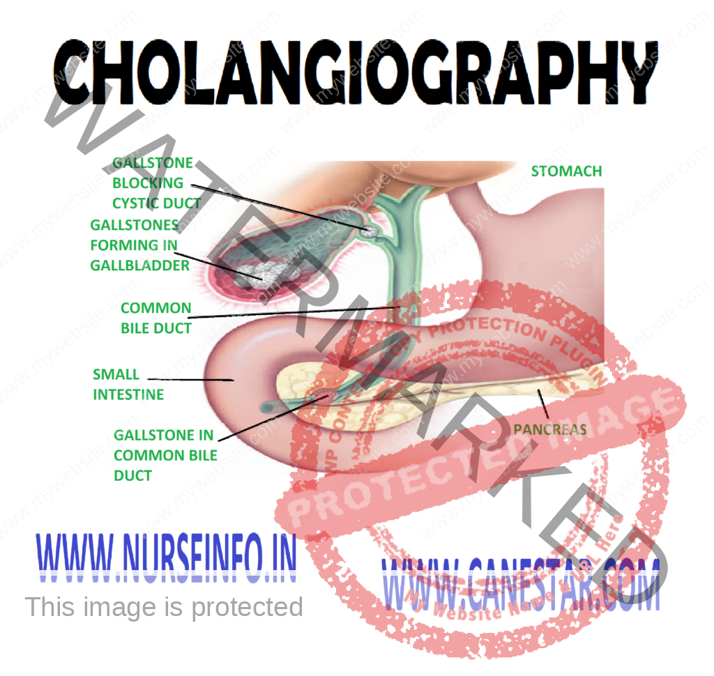 CHOLANGIOGRAPHY (INTRAVENOUS, PERCUTANEOUS, T-TUBE) - Description, Clinical Problem, Client Preparation and Procedure 