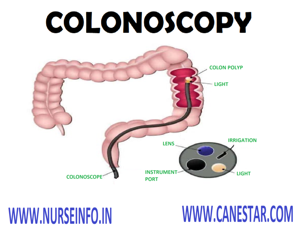COLONOSCOPY – Definition, Purpose, Indication, Principle, General Instruction, Preliminary Assessment, Preparation of the Article, Preparation of the Patient, Procedure, After Care and Complication
