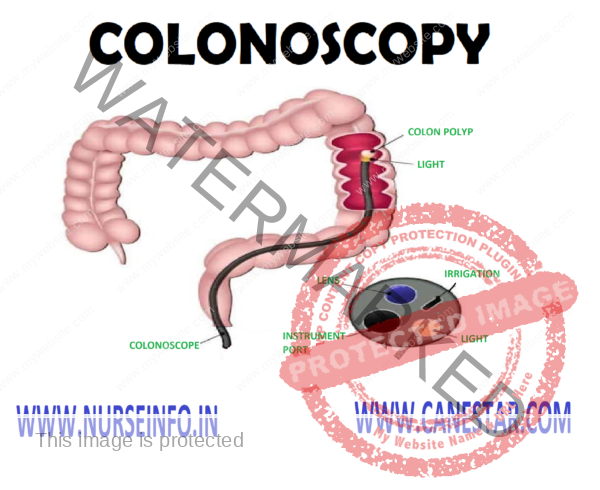 COLONOSCOPY - Nurse Info