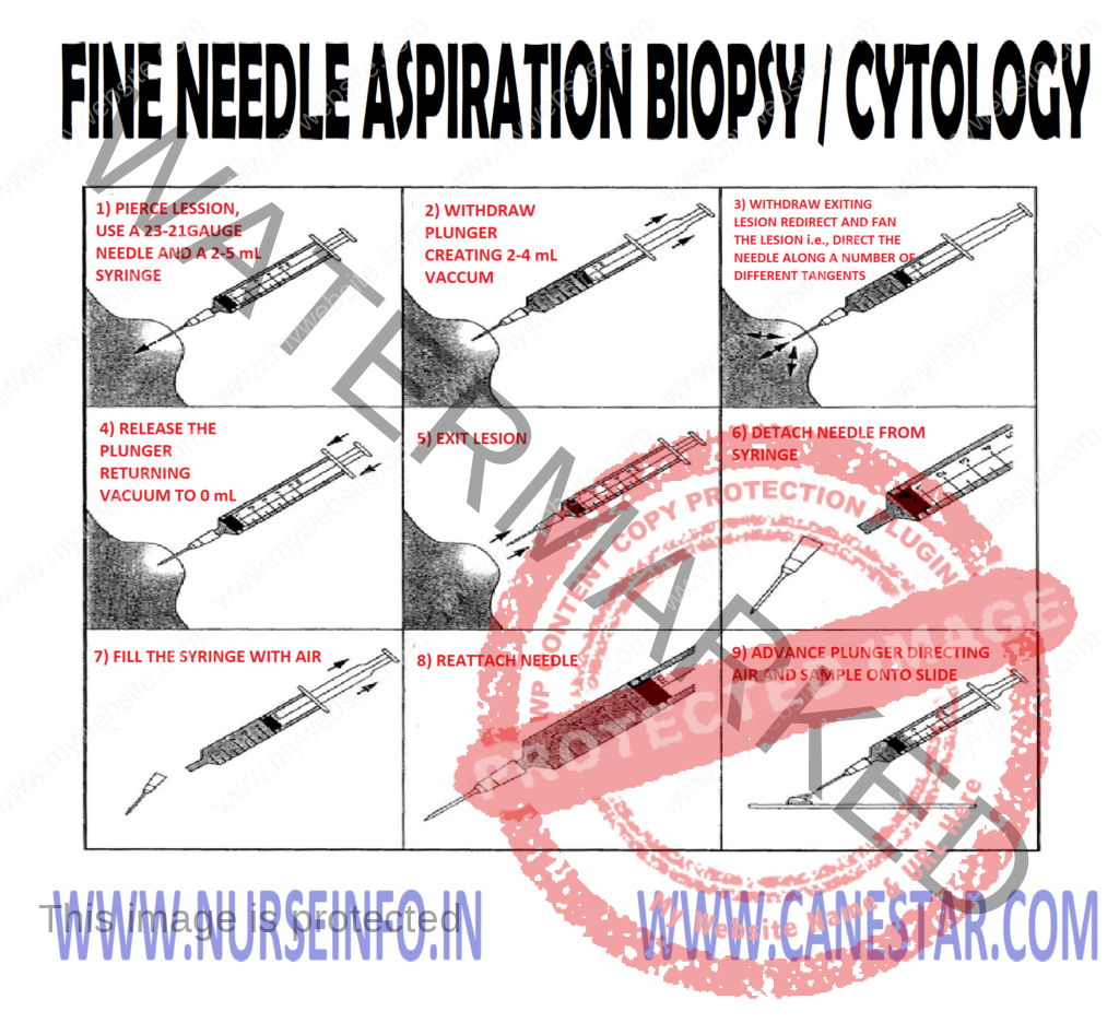 Fine Needle Aspiration Lymph Node Biopsy