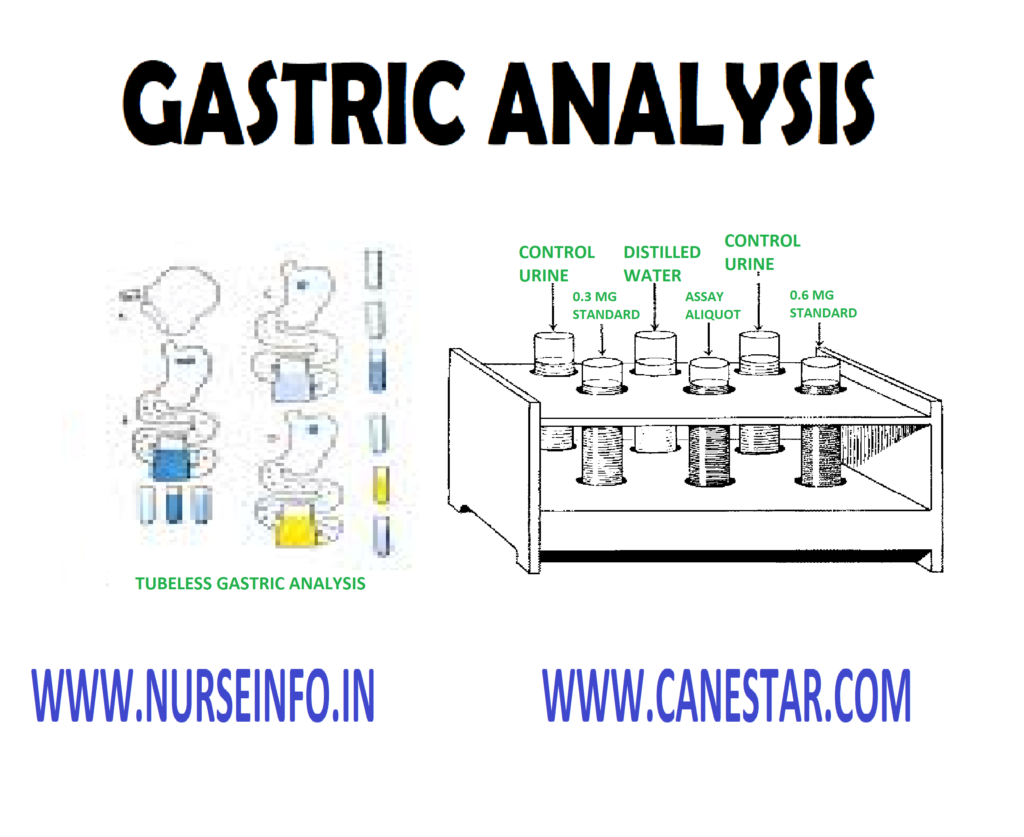 GASTRIC ANALYSIS – Basal Gastric Analysis (Tube), Stimulation Gastric Analysis (Tube), Tubeless Gastric Analysis, Normal Findings, Purpose, Clinical Problems, Client Preparation, Procedure, Tubeless Gastric Analysis and Factor Affecting Diagnostic Results