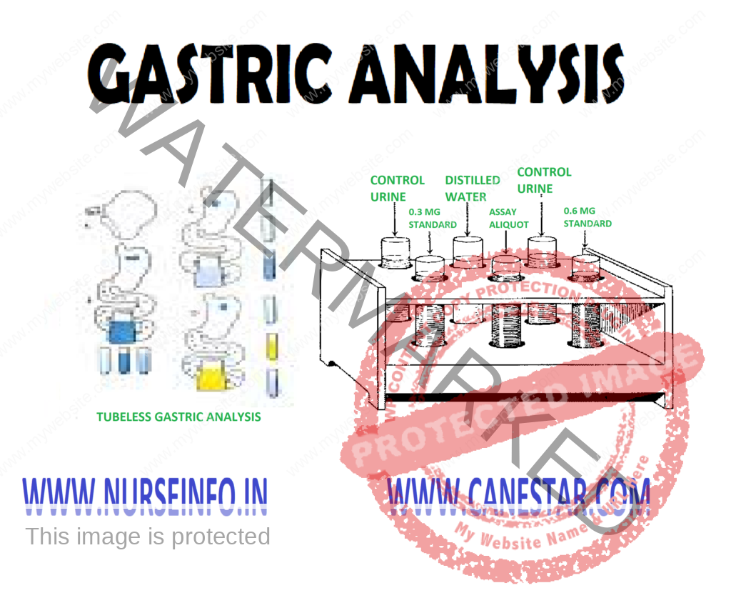 GASTRIC ANALYSIS – Basal Gastric Analysis (Tube), Stimulation Gastric Analysis (Tube), Tubeless Gastric Analysis, Normal Findings, Purpose, Clinical Problems, Client Preparation, Procedure, Tubeless Gastric Analysis and Factor Affecting Diagnostic Results 