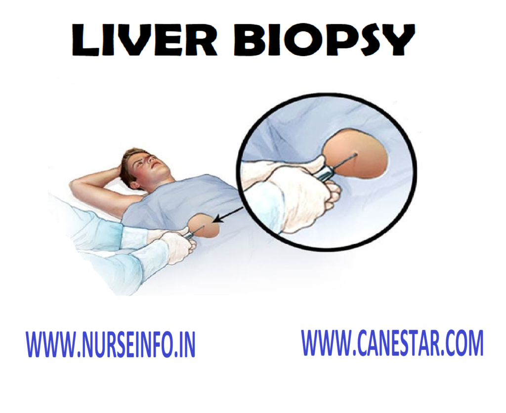 LIVER BIOPSY – Definition, Purpose, Indication, Contraindication, General Instruction, Preliminary Assessment, Preparation of Patient and Environment, Articles Needed, Procedure, After Care and Complication 