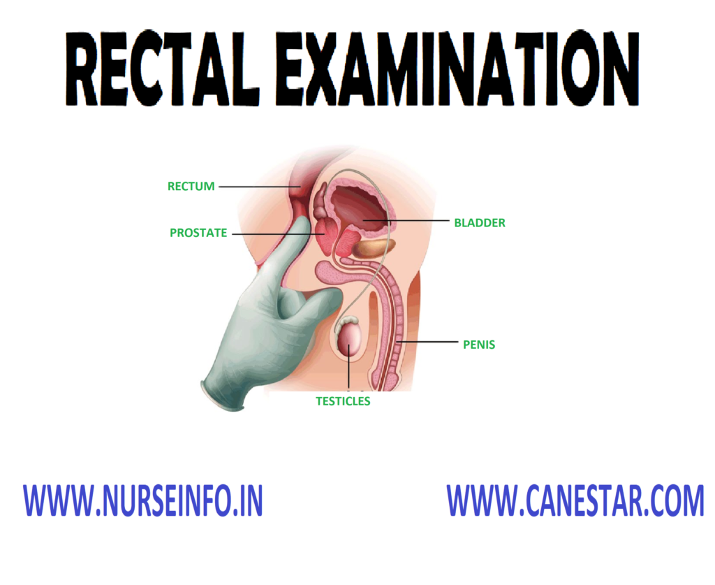 RECTAL EXAMINATION – Purpose, Method and Position, Preliminary Assessment, Preparation of the Patient and the Environment, Equipments, Procedure and Complications 