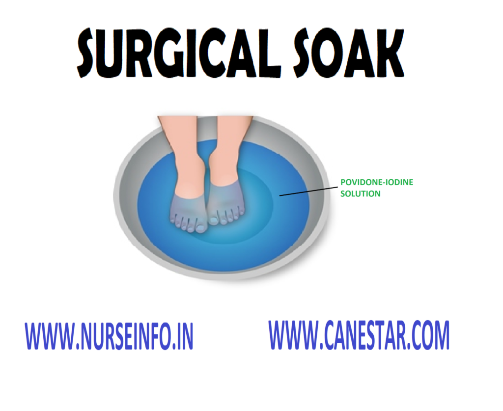 SURGICAL SOAK – Purpose, Preliminary Assessment, Preparation of the Patient, Equipment, Solutions Used and Procedure