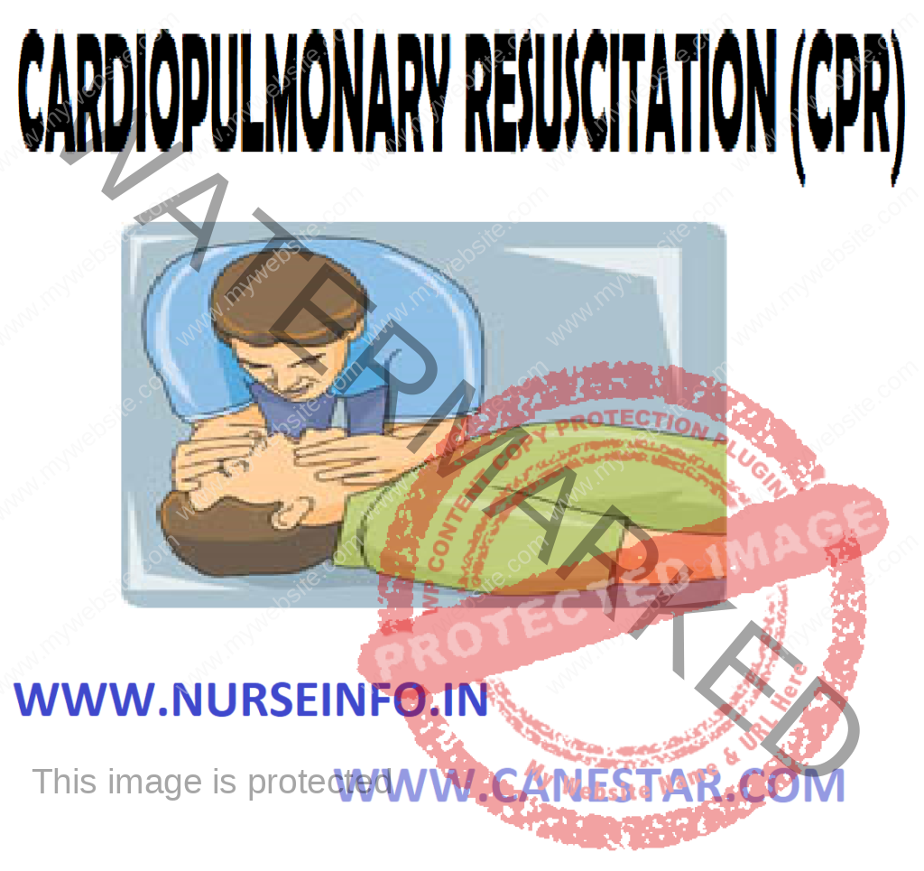 CARDIOPULMONARY RESUSCITATION (CPR) (Definition, Purpose, Equipment, General Instructions, Procedure, Method, Do’s and don’ts in CPR and Complications. 