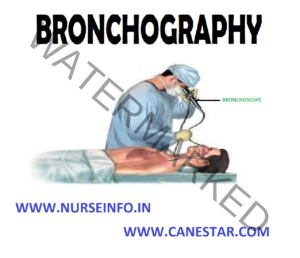 BRONCHOGRAPHY - Nursing Notes, MCQs & Procedures %post_title ...