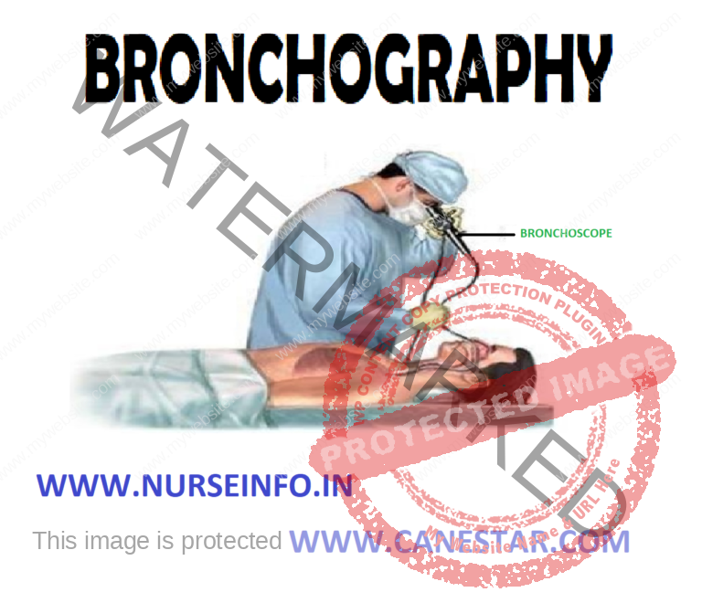 BRONCHOGRAPHY - Nursing Notes, MCQs & Procedures %post_title ...