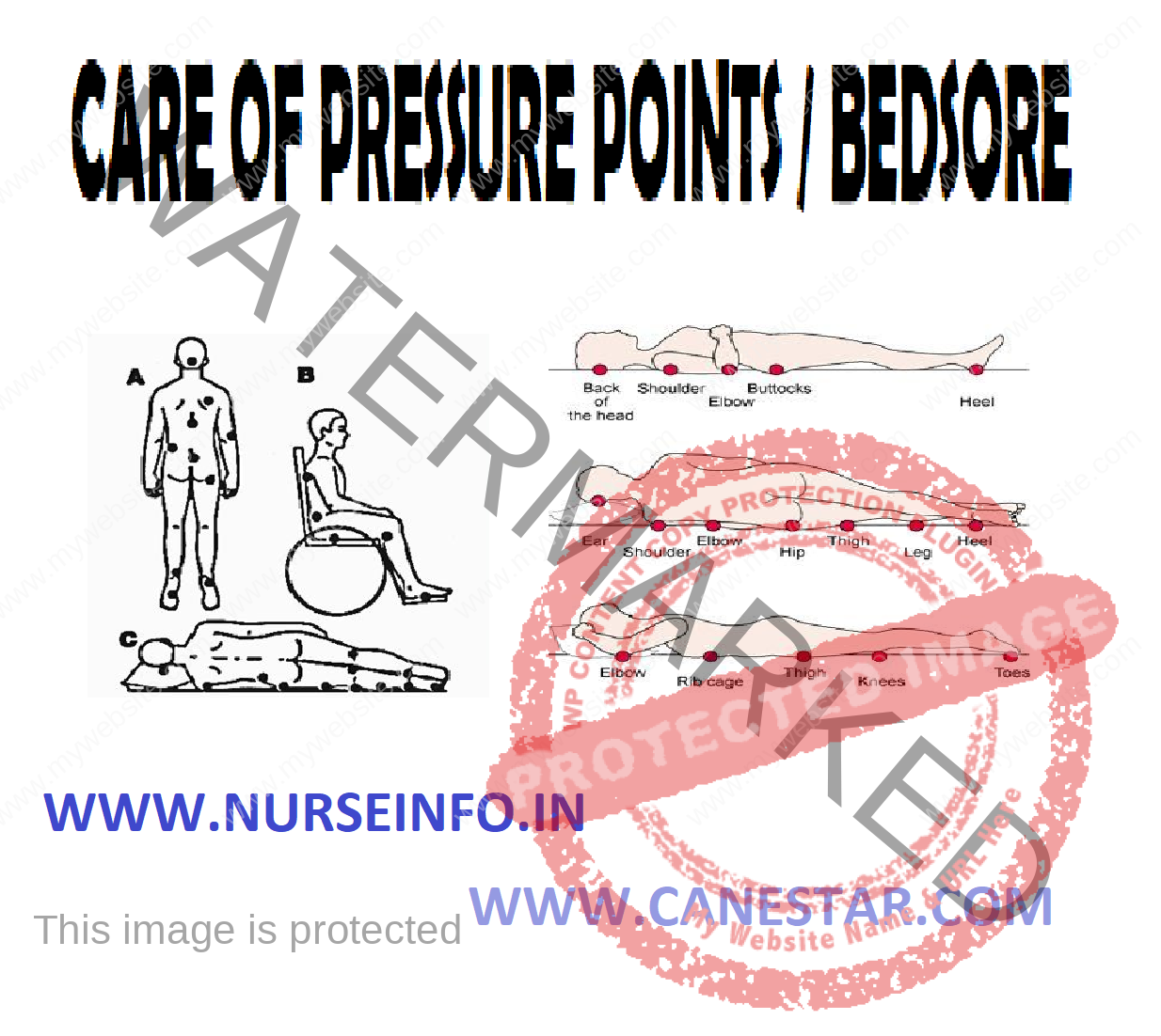 care-of-pressure-ponts-bed-sore-nurse-info