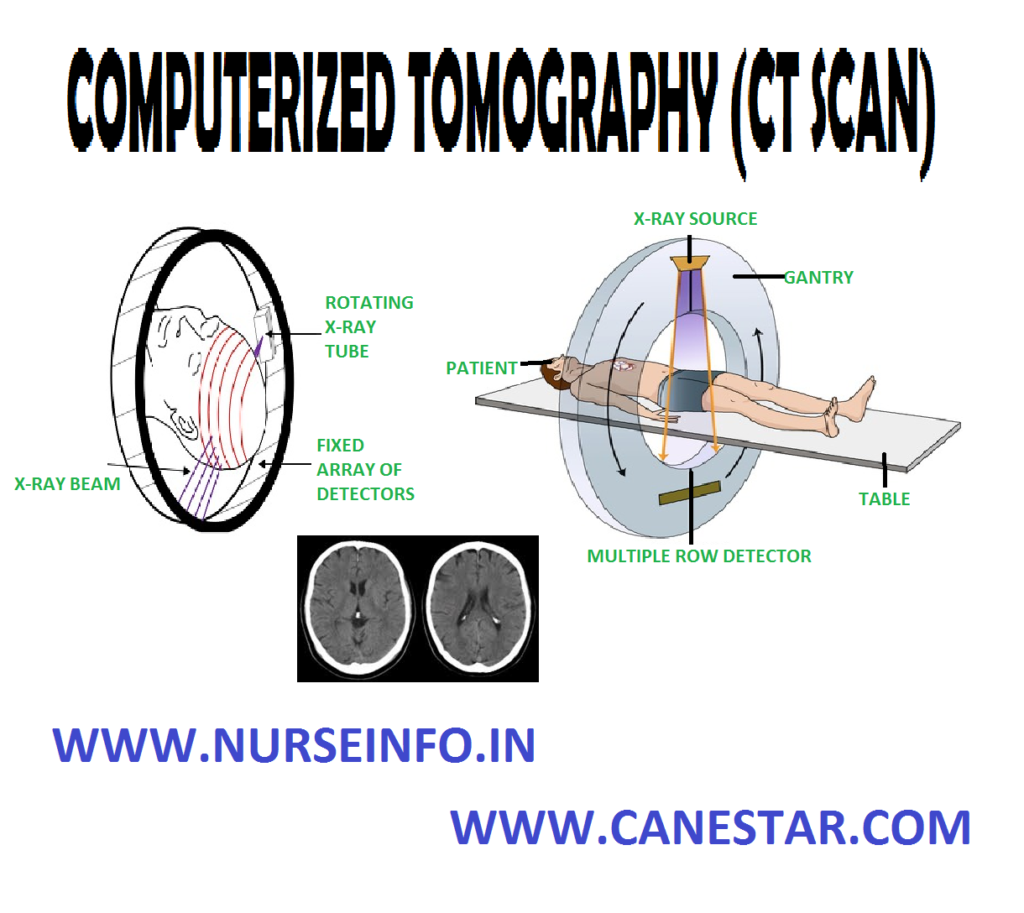 COMPUTERIZED TOMOGRAPHY (BRAIN) – Definition, Purposes, Indications, Preparation of the Client, Procedure, After Care, Complications, Contraindications, Side Effects and Advantages