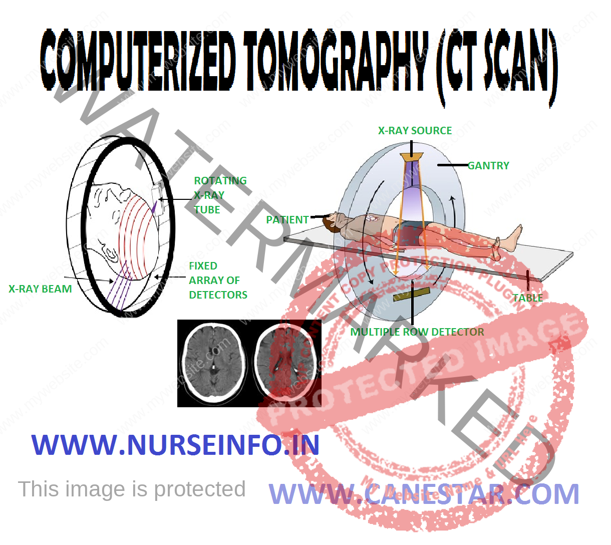 COMPUTERIZED TOMOGRAPHY - Nurse Info