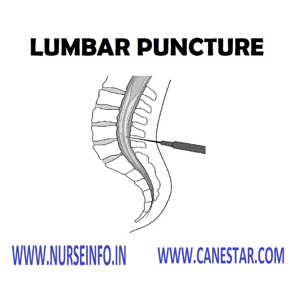 LUMBAR PUNCTURE – Definition, Purpose, Indications, General Instructions, Special Considerations, Equipment Needed, Queckensted’t Test (Lumbar Manometric Test), After Care, Contraindications and Complications