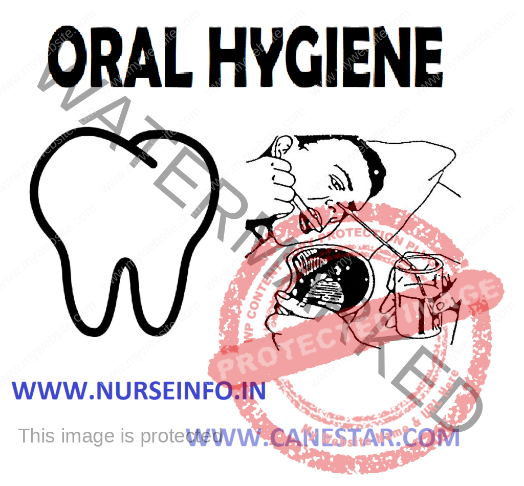 ORAL HYGIENE - Care of Independent , Dependent & Unconscious Patients , Care of Dentures