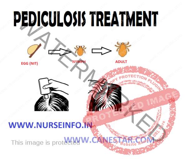 PEDICULOSIS TREATMENT Nurse Info