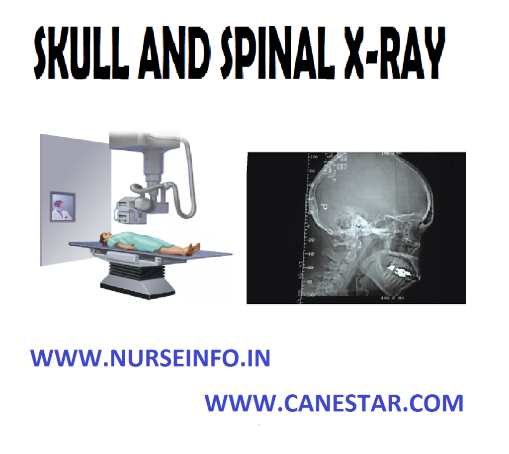 SKULL AND SPINAL X-RAY – General Instructions, Procedure and After Care